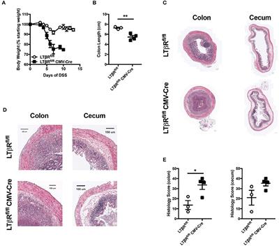 The Tumor Necrosis Factor Superfamily Members TNFSF14 (LIGHT), Lymphotoxin β and Lymphotoxin β Receptor Interact to Regulate Intestinal Inflammation